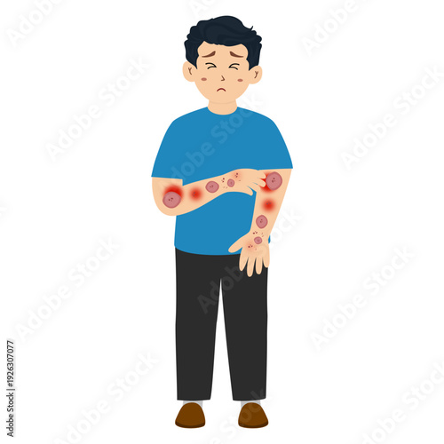 Man suffering from a skin rash. Distressed man from a severe skin rash, allergies, and eczema.