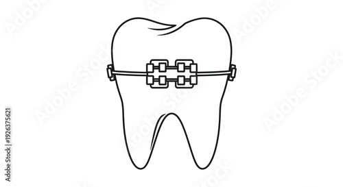 Line drawing of a tooth with orthodontic braces attached to the front