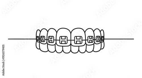 Line drawing of human teeth with metal braces isolated on a white background