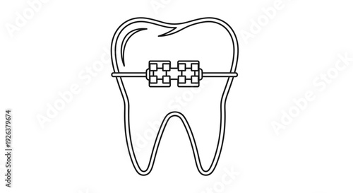 Line drawing of a tooth with metal braces representing orthodontic treatment