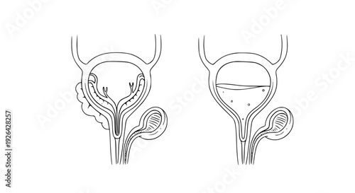Human Bladder Anatomy Vector – Empty and Full Urinary Bladder Illustration