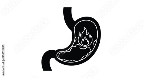 Illustration of a human stomach showing internal inflammation and burning