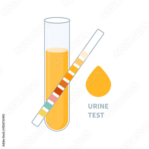 Urine sample tube and urinalysis reagent strip for kidney exam, urinary tract infection and cystitis diagnostics. Ketone and PH rapid test strips for ketogenic and alkaline diets. Vector illustration.
