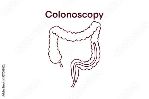 Educational coloring illustration depicts colonoscopy process in large intestine using endoscope. Medical drawing showing detection of polyps, cancer, and internal health diagnostics.