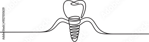 Dental implant with crown, hand-drawn in one continuous endless line on a white background, vector. The false tooth icon. one line Icon drawing