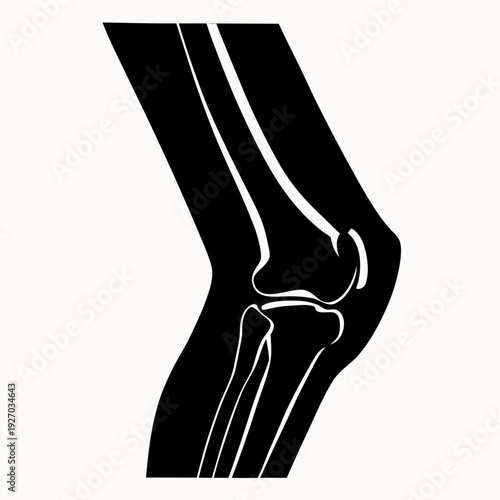 Anatomical illustration of a human knee joint in black and white