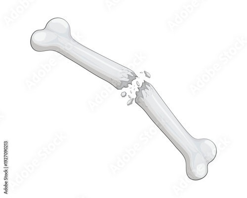 Vector illustration design of a bone that is broken in the middle because it is brittle and several small parts are visible scattered around the fracture.
