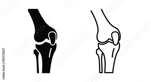Anatomical illustration of human knees in a stark black silhouette