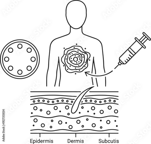 Line art vector illustration showing human skin anatomy layers epidermis dermis and subcutis with medical syringe injection and cell structure for dermatology healthcare education.