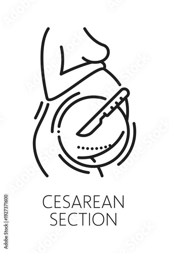 Cesarean section gynecology medical line icon or sign. Pregnancy healthcare outline sign, urinary health and woman fertility vector icon. Reproductive health, gynecology symbol with womb and scalpel