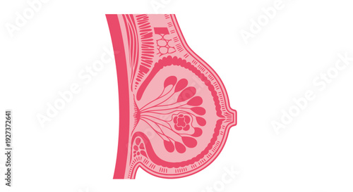 Breast Cancer Cross Section Medical Flat Vector Illustration