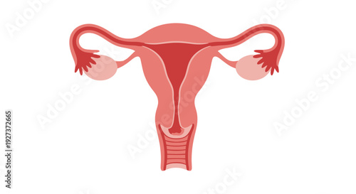 Cervical Cancer Flat Vector Medical Illustration