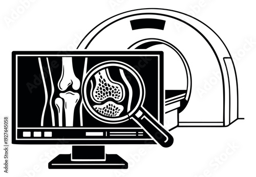 Line art illustration of a knee joint scan depicting bone structure analysis for medical diagnosis