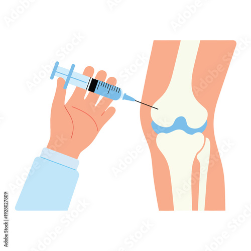Illustration depicting a knee injection procedure with a syringe and hand