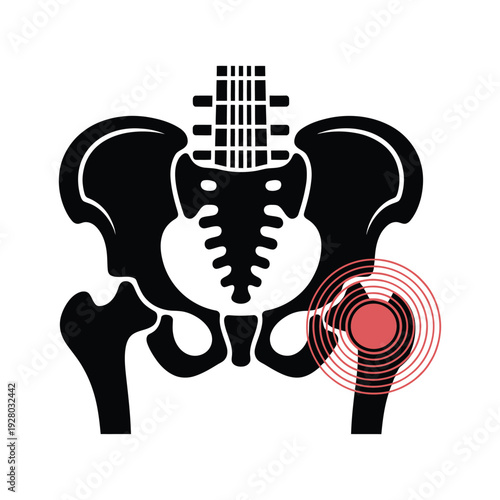 Human pelvis and lumbar spine illustration with highlighted hip joint pain