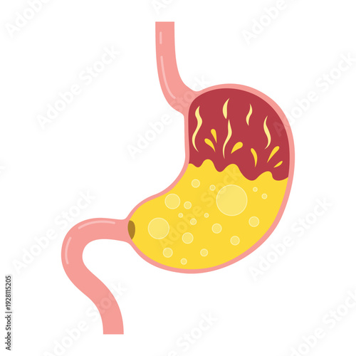 An illustration of the human stomach filled with gastric juice, symbolizing the digestive process. The stomach is depicted with crisp detail and vibrant colors.