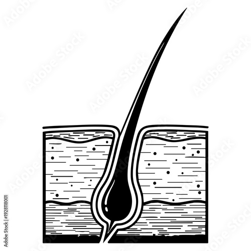 Microscopic Cross Section Diagram Showing Human Hair Follicle Anatomy Within Skin Layers