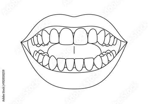 Black and white outline drawing of an open mouth showing upper and lower teeth
