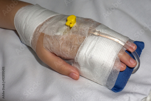 patient's hand with an intravenous (IV) catheter and bandage, medical treatment in a hospital. Selective focus 