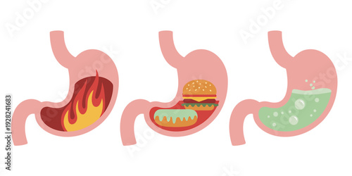 Three cartoon stomachs with different contents and reactions  burning food and digestion