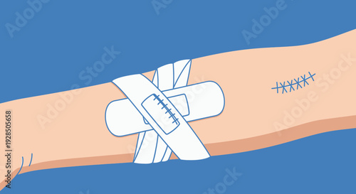 Arm Injury Depicted With Bandage and Stitches, A Medical Healing Visual Illustration