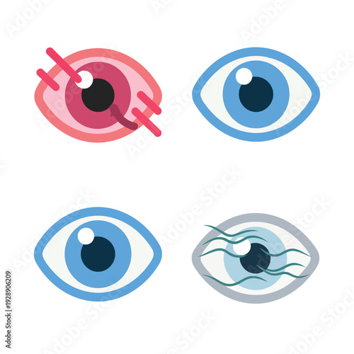 Eye disease icons for ophthalmology showing cataract opacity, glaucoma pressure, retina damage, astigmatism blur, clinical vision care infographic set