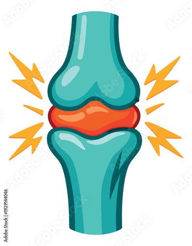 Stylized illustration of a human joint depicting painful inflammation for medical concept