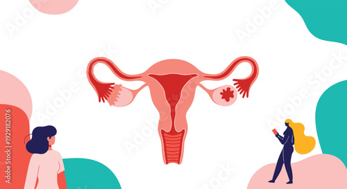 Anatomical illustration of the female reproductive system showing the uterus fallopian tubes and ovaries with women in the background.