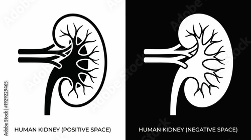 Kidney Anatomy Vector – Healthy Kidney vs Anatomical Structure, Medical Illustration Graphic