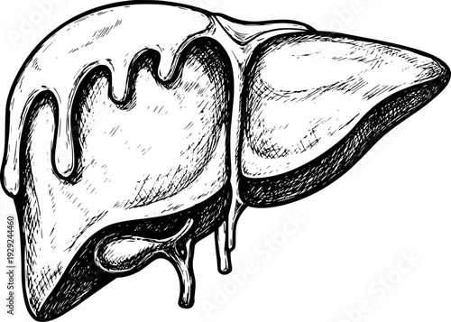 Hand Drawn of a Diseased Liver with Dripping Fluid White Background organ human