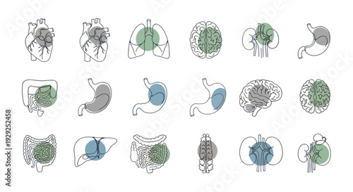 Cells with Various Stages of Infection Illustrated.