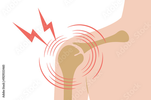 Pain in human knee joint  bone ache