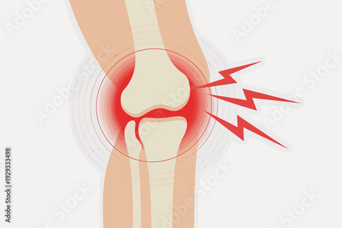 Knee joint pain and injury illustration