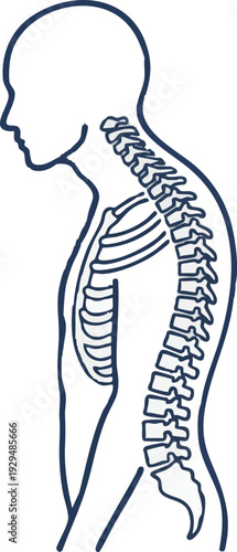 Illustration of a Human Spine Showing Poor Posture and Vertebral Alignment