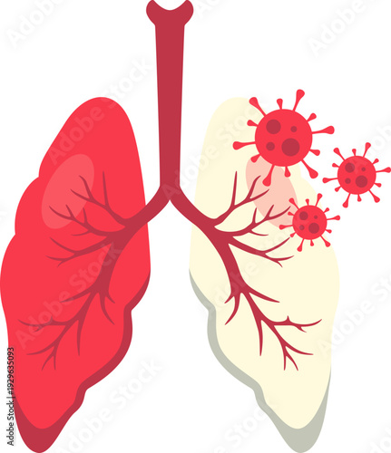 World tuberculosis day illustration. Lung infection, lung health, tuberculosis awareness. Vector isolated.