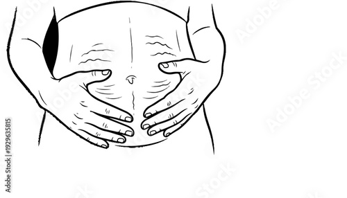 A black and white sketch of hands cradling a pregnant belly, showing stretch marks