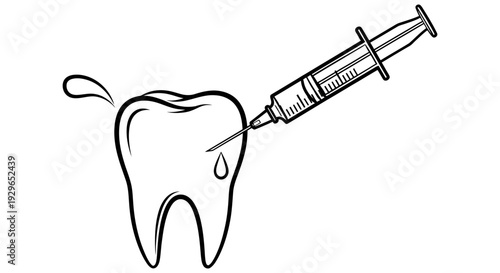 Dental injection being administered to a tooth with a syringe for medical treatment or procedure illustration
