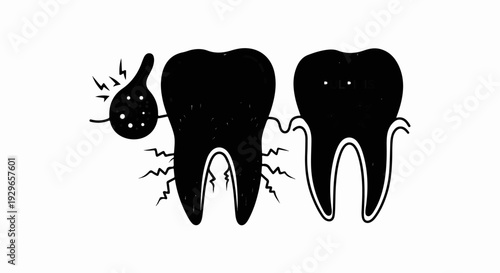A cartoon depicts two molars, one with a painful, inflamed nodule, the other healthy