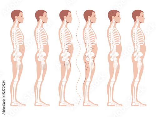 Human Spine and Posture Variations Illustrated in Six Different Positions and Alignment
