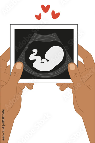 A woman's hands hold a screening photo. The photo shows a baby in early pregnancy. The photo shows the baby's embryo