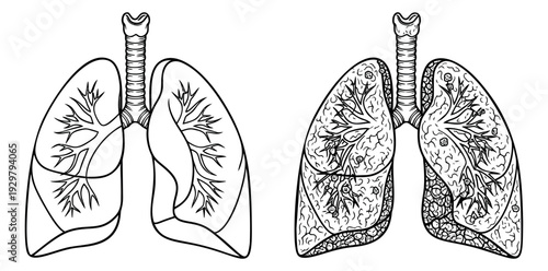 Hand drawn line art human lungs anatomy set featuring healthy and diseased respiratory organs for medical education and health awareness