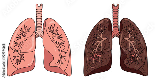 Hand drawn line art human lungs set featuring healthy and diseased organs for medical and health education