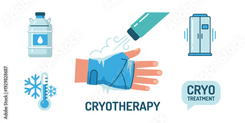 Cryotherapy concept with hand receiving targeted cold treatment, representing medical therapy and recovery process