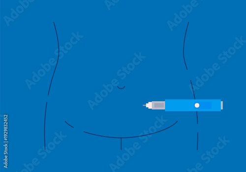 Semaglutide Injection Pen. Semaglutide therapy on diabetes management abstract concept. Weight Loss Medication Semaglutide Injection