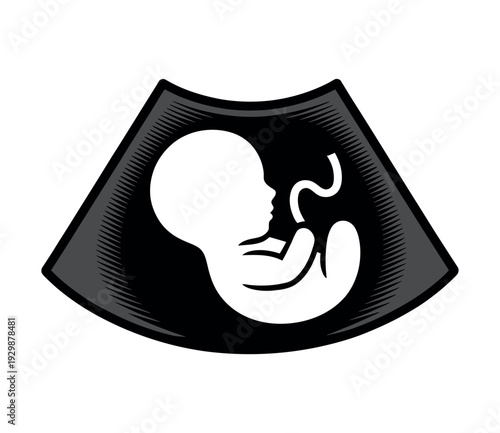 A medical illustration of a fetus in the womb, shown in a black and white sonogram image.