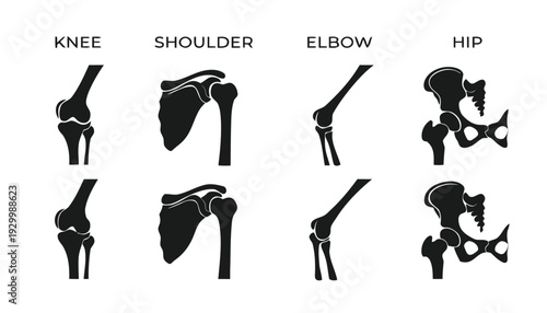 Set of anatomical illustrations of human joints: knee, shoulder, elbow, and hip, in profile and anterior views.