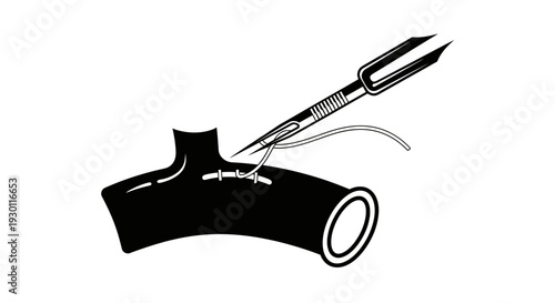 Medical procedure showing meticulous vascular suturing with needle and thread for surgical repair