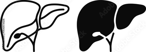 Comparison of healthy and diseased liver anatomy with bile ducts and gallbladder Vector