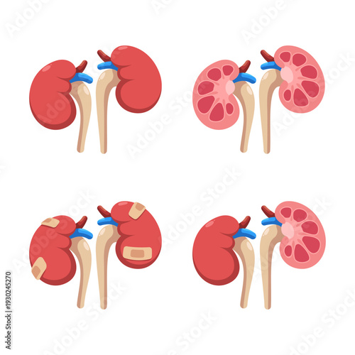 Kidney anatomy and health icons set, flat vector illustration of renal system, medical cross section and injured kidney with bandage.