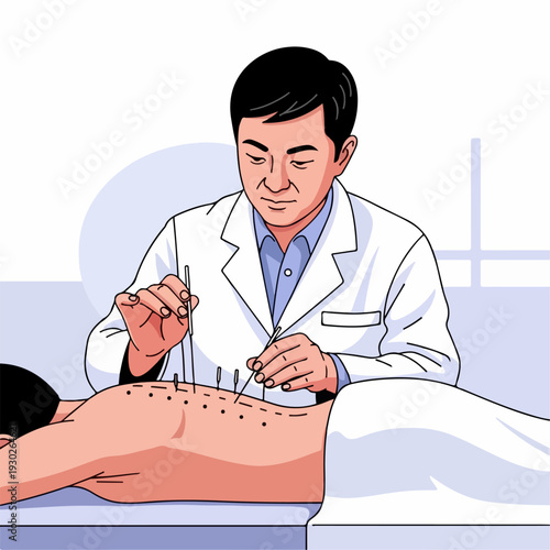 Vector illustration of a person treating acupuncture points